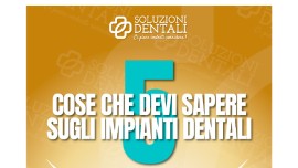 5 cose che devi sapere sugli impianti dentali