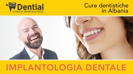 I dentisti di Tirana e Durazzo rappresentano l'alternativa albanese alle cliniche dentali in Croazia