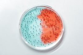 Batteri resistenti agli antibiotici, una pandemia mondiale.  Prima causa di morte nel 2050 con 10 milioni di decessi ogni anno