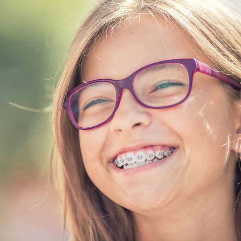 L'apparecchio per i denti: tutto quello che c'è da sapere