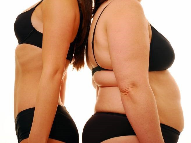 Possibile relazione tra malattie autoimmuni e obesità